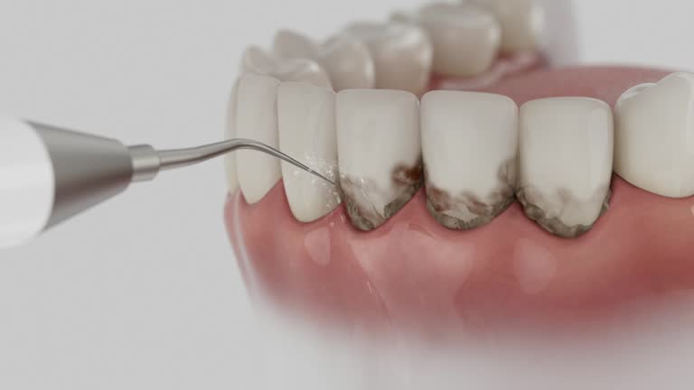 Trusted Teeth Cleaning And Checkup service in Lowry Crossing, TX - Dentist Open Now